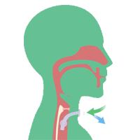 Tracheostomy Care Service